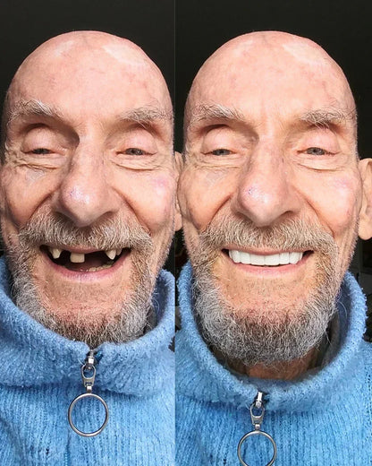EARLEPS LuxeSmile Biyouyumlu Yeni Nesil Takma Dişler