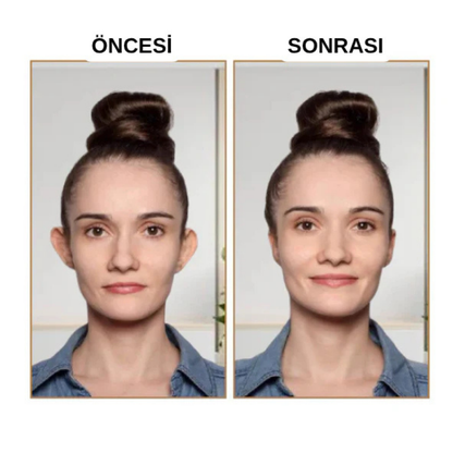 Earleps Kepçe Kulak Klipsi ( Doğal Kulak Şekillendirme ) 20 Adet