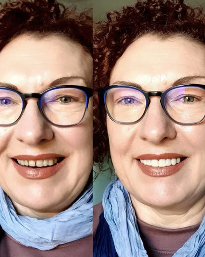 EARLEPS LuxeSmile Biyouyumlu Yeni Nesil Takma Dişler