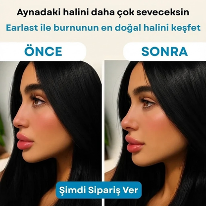 EARLEPS BURUN KALDIRMA APARATI